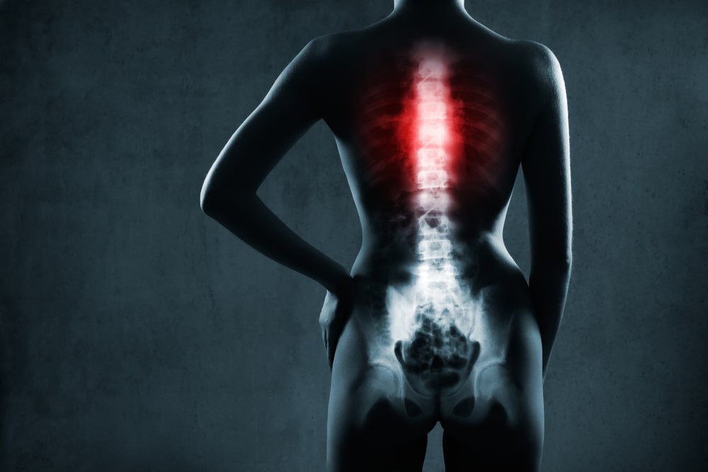 personal injury lawyer