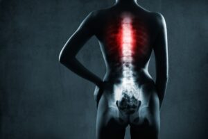 spinal cord injury lawyer in Grass Valley, CA